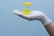 Urine Berbusa, Normal atau Pertanda Ginjal Bermasalah? Ini Kata Dokter