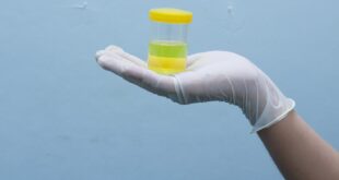 Urine Berbusa, Normal atau Pertanda Ginjal Bermasalah? Ini Kata Dokter